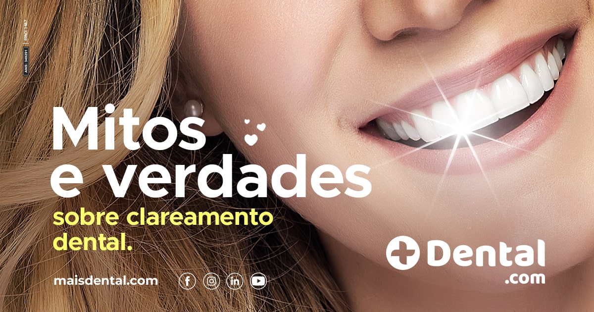 Mitos E Verdades Sobre Clareamento Dental | MaisDental